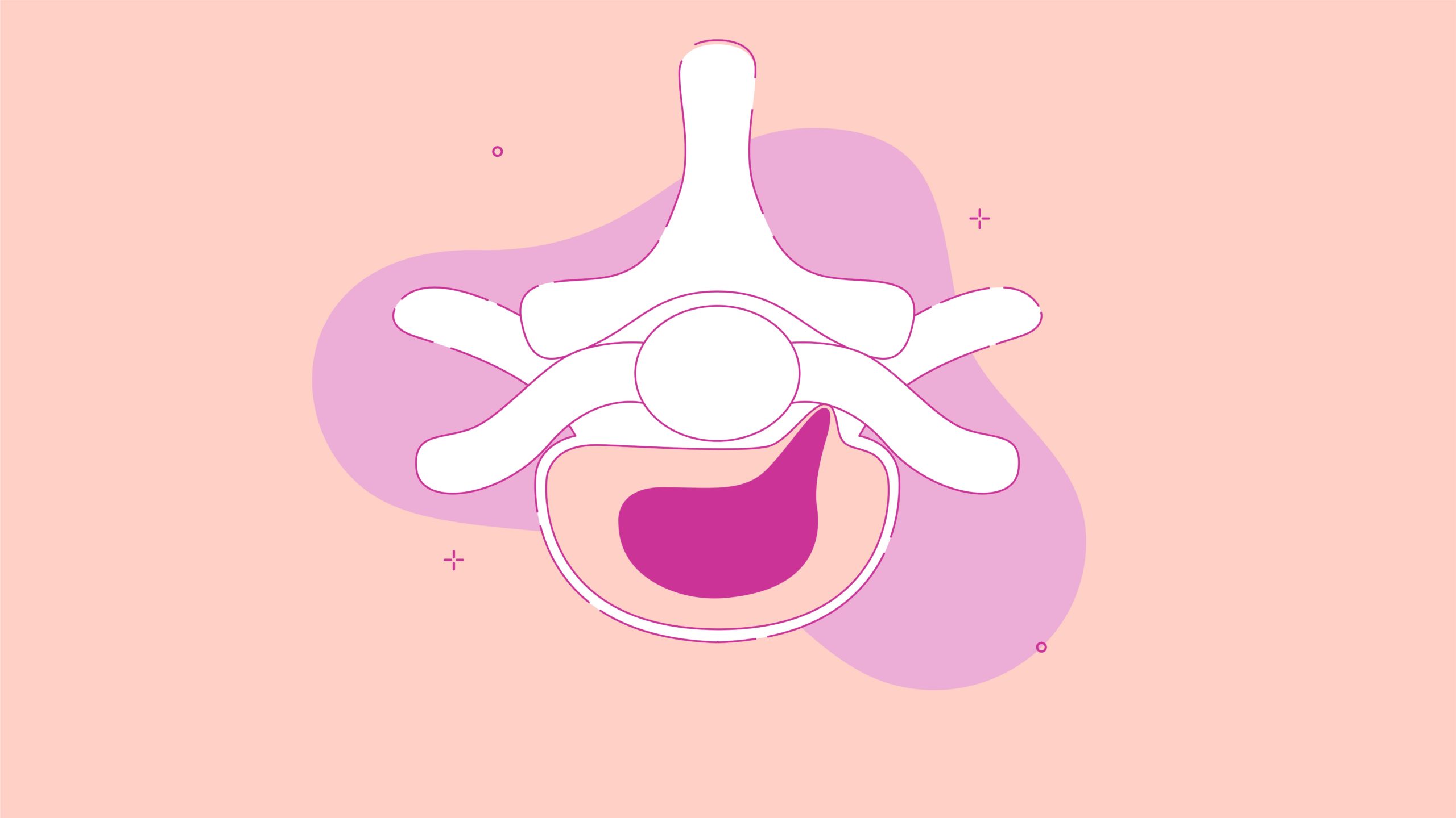 best-mattress-for-herniated-disc